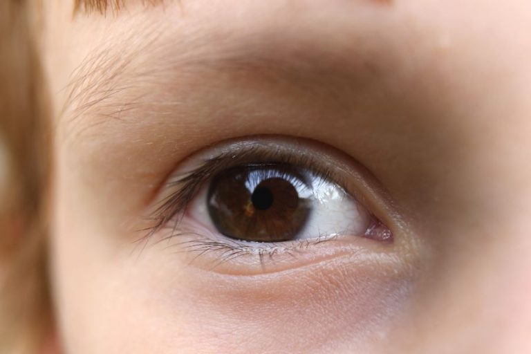 Primer plano del ojo de un niño que representa señales tempranas de miopía en la infancia